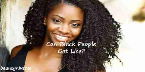 can black people get lice