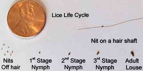 what do nits baby dead lice bug look like in dark brown hair