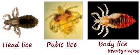 where do lice originate from