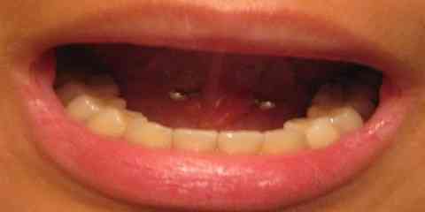 pictures of tongue piercings different types options examples images