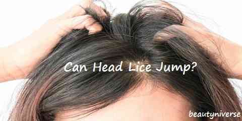 can head lice jump